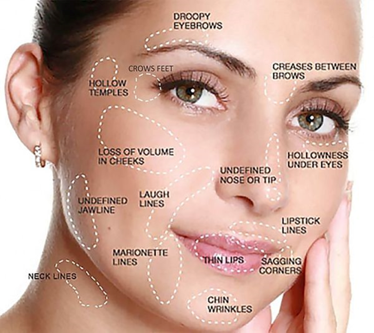 Dermal Fillers London - Zen HealthCare