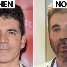 Top 3 Non-Surgical Aesthetic Treatments for Men - zen healthcare